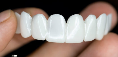 BowLift | Snap-On Cosmetic Veneers | Instant Smile Cover for Imperfections