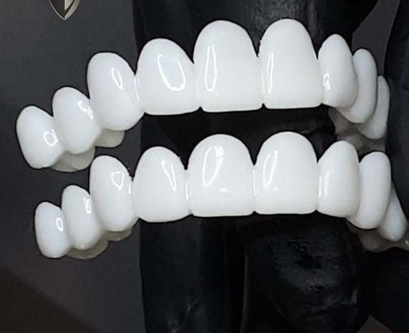 BowLift | Snap-On Cosmetic Veneers | Instant Smile Cover for Imperfections